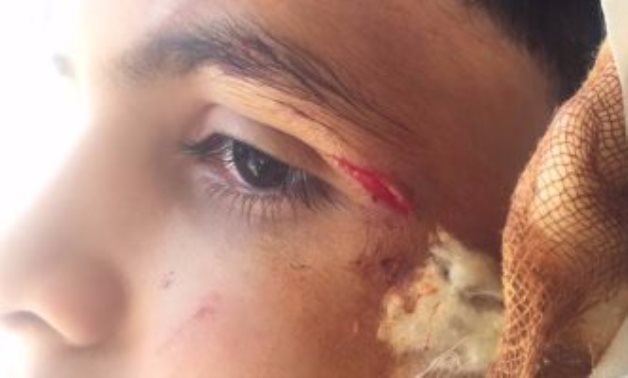 بالصور.. إصابة طالب بمدرسة فى الإسكندرية.. و"التعليم" تحقق