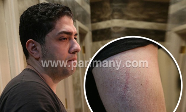 ننشر صور الزميل الصحفى محمد طارق بعد اعتداء النائب محمود خميس عليه بالضرب 
