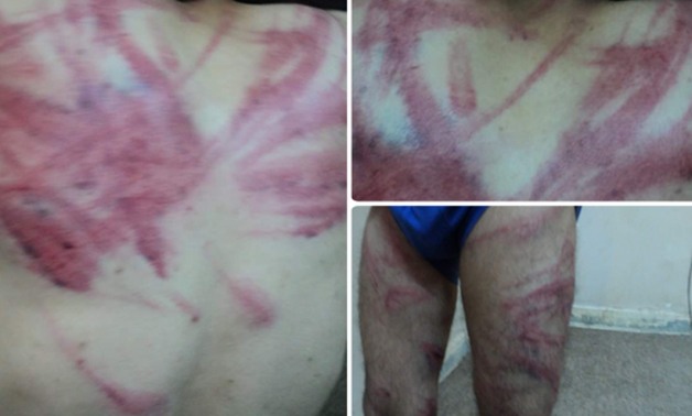 بالصور.. خطف وتعذيب مواطن مصرى فى مدينة "سبها" الليبية